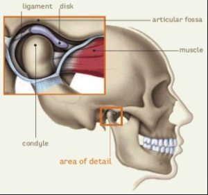 lock jaw Archives Warman Physiotherapy Wellness